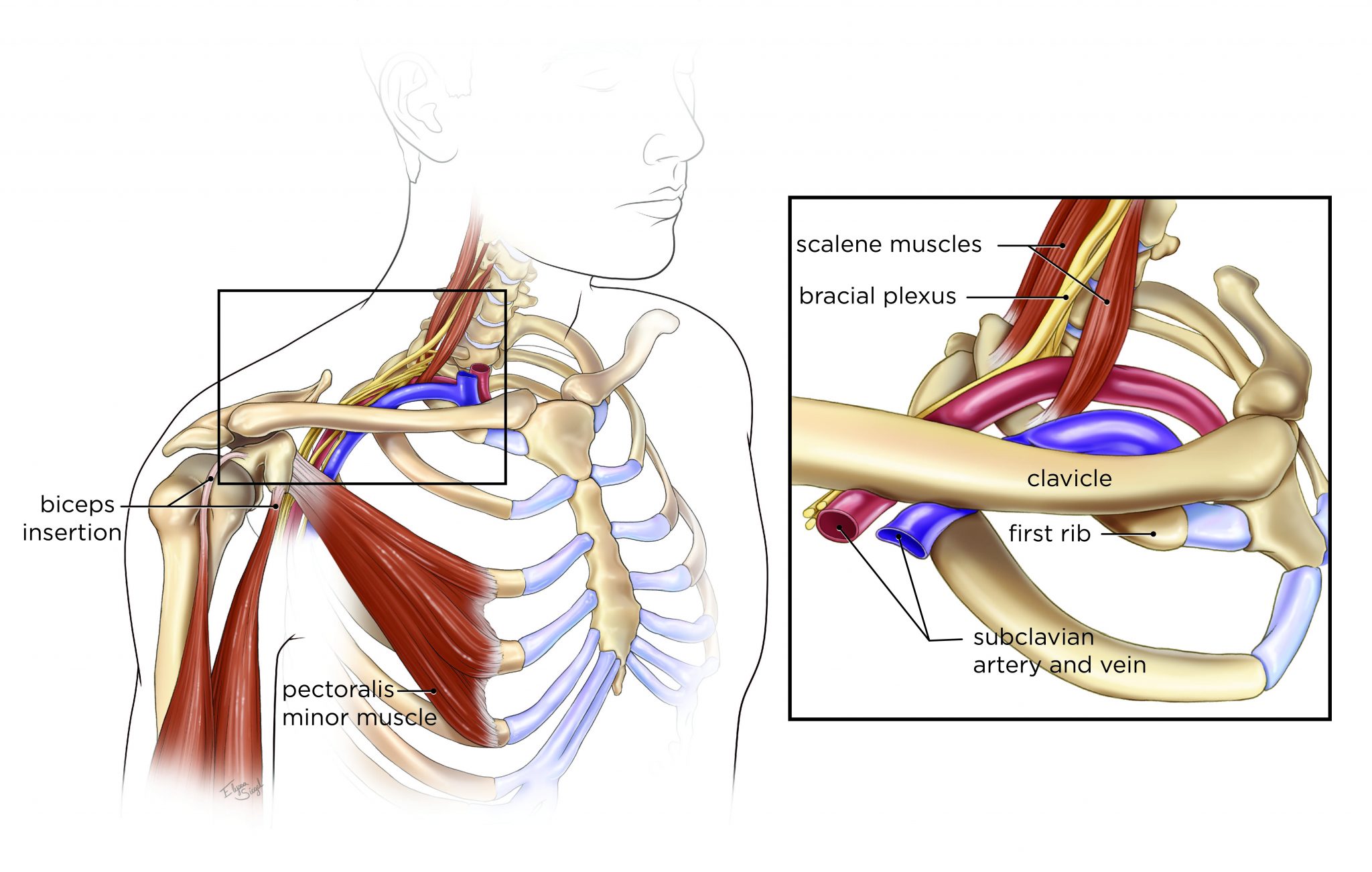 thoracic outlet syndrome test